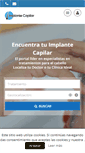 Mobile Screenshot of implante-capilar.com