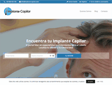Tablet Screenshot of implante-capilar.com